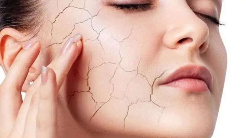 عادات صباحية تزيد جفاف البشرة شتاء.. وآخرها شائع جداً